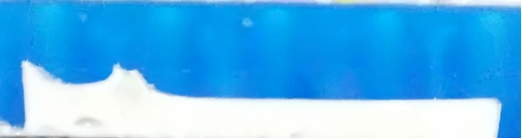 为什么我的凝胶DNA回收率低_新闻资讯_第1张_活检穿刺产品网 为什么我的凝胶DNA回收率低_https://www.jmylbn.com_新闻资讯_第1张