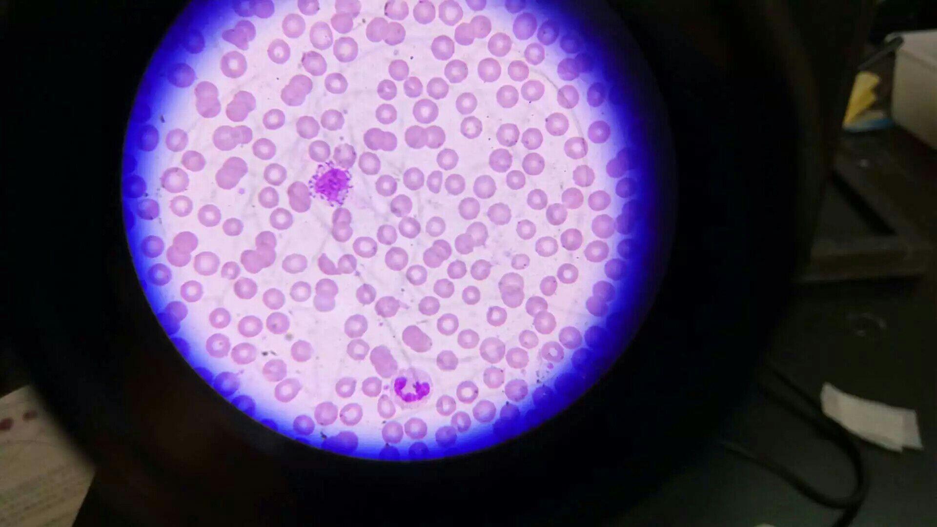 各种血型显微镜下图片图片
