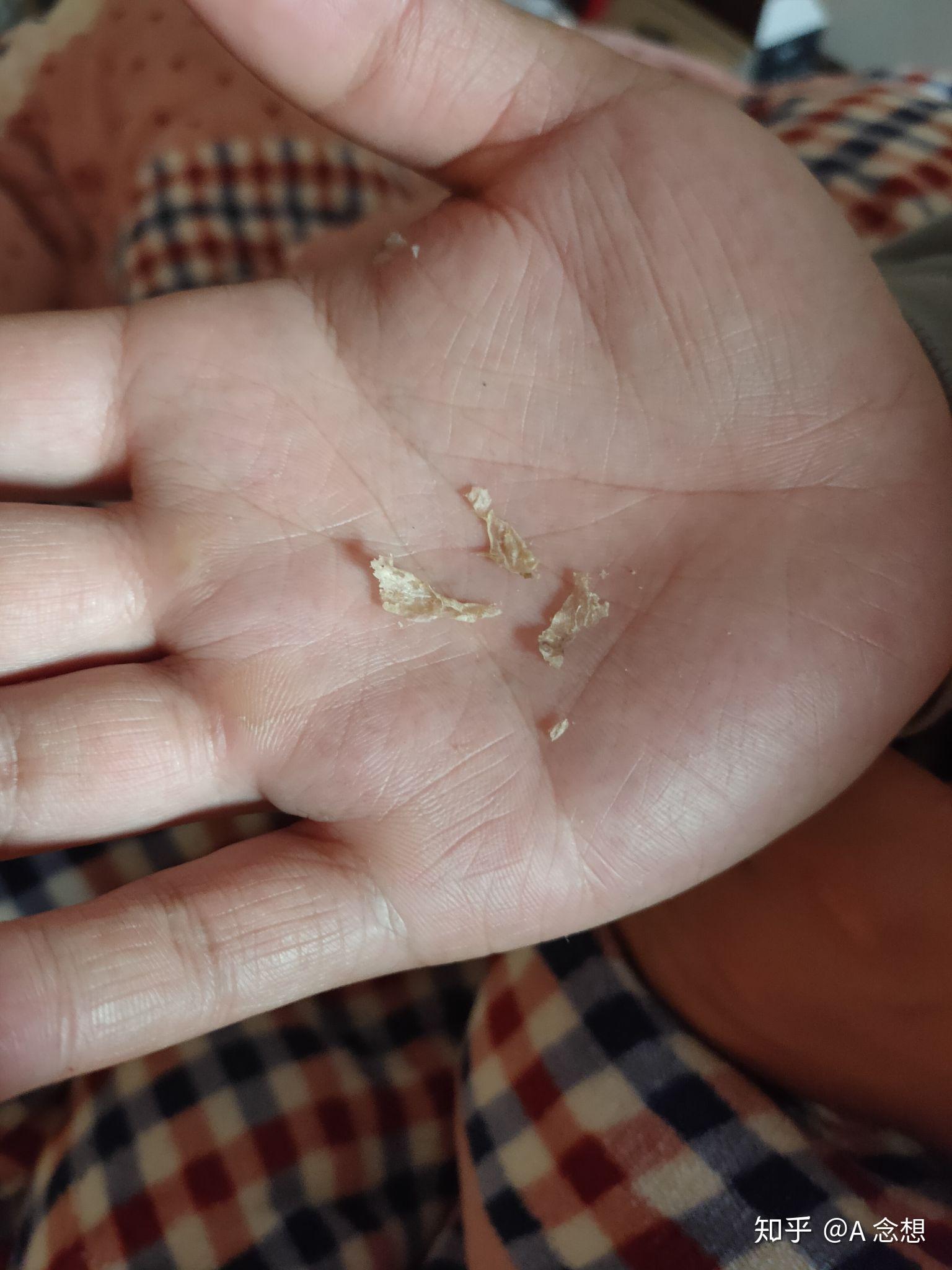 耳屎能大到什么程度