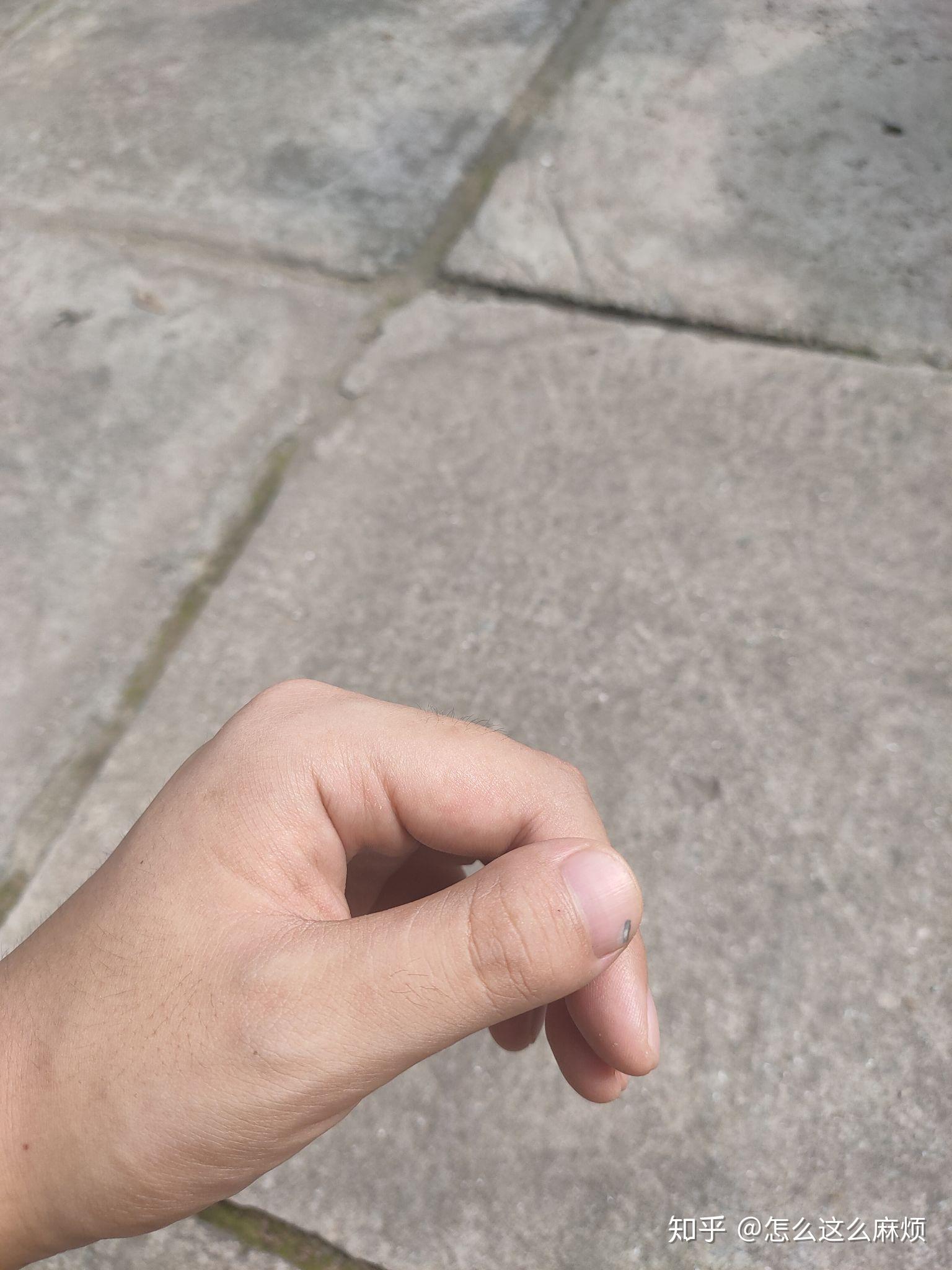 有多少人大拇指较短,且指头很粗/宽?是基因还是水土问题? - 知乎