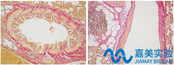 picricacid酸性复红vg染色