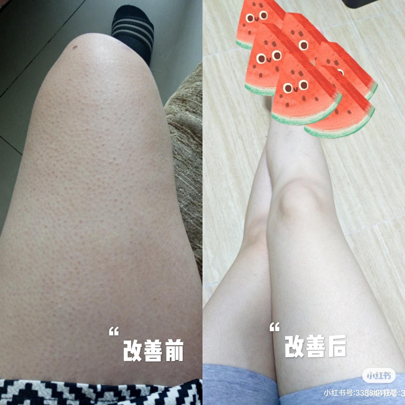 如何弄掉鸡皮肤(怎么才能去掉鸡皮肤)