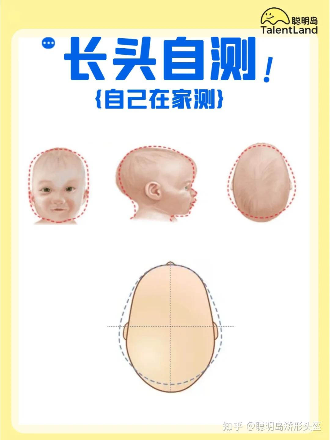 如何判断宝宝头型是不是长头舟状头 - 知乎