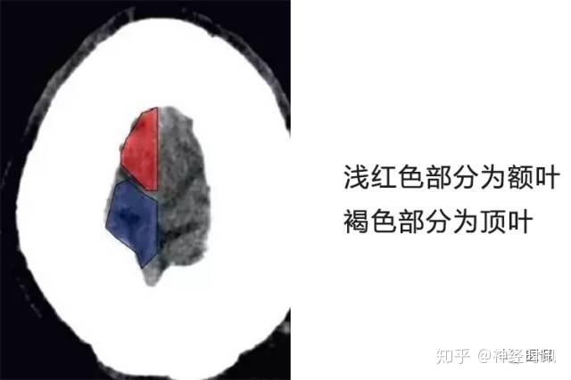 解剖&影像 —— 颅脑CT解剖口诀及彩色解剖图 - 知乎