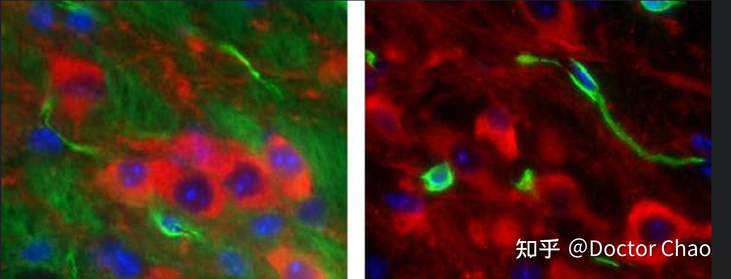 石蜡切片和冰冻切片之高质量HE染色、免疫组化、免疫荧光染色 - 知乎