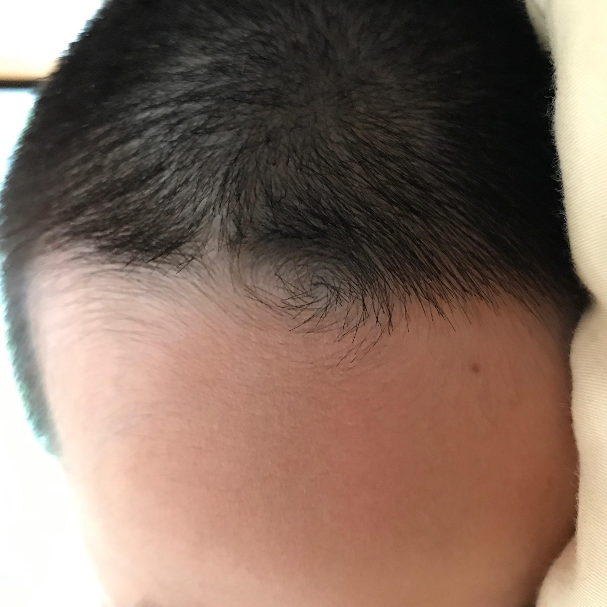 婴儿眉尾有旋的图片图片