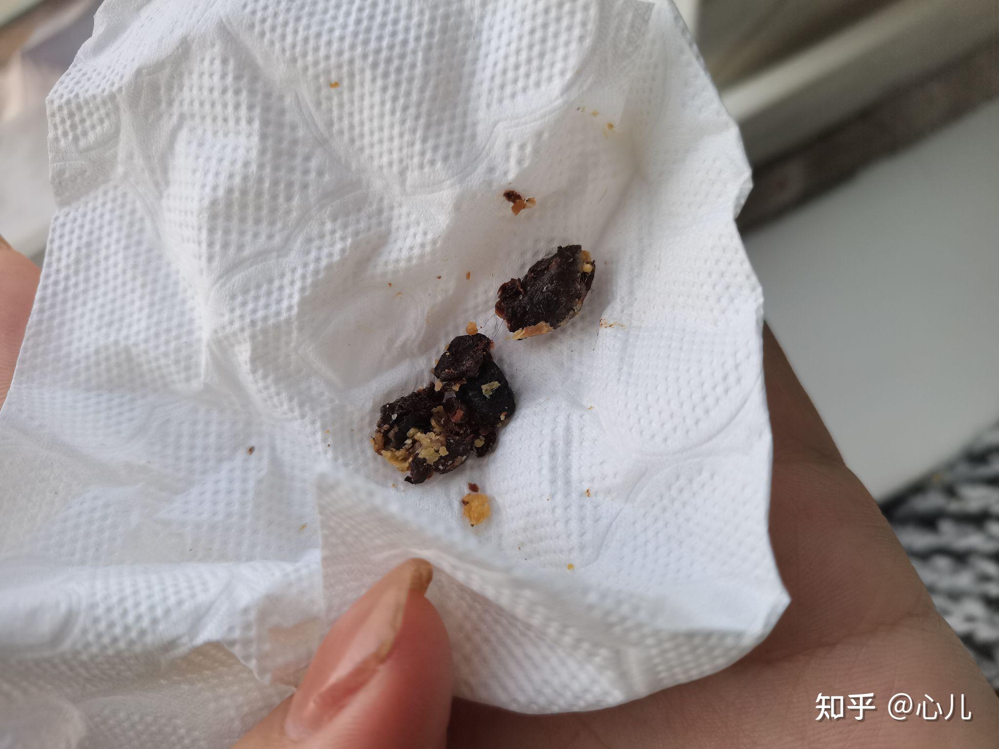 掏出一块超大耳屎,是种什么体验? - 知乎