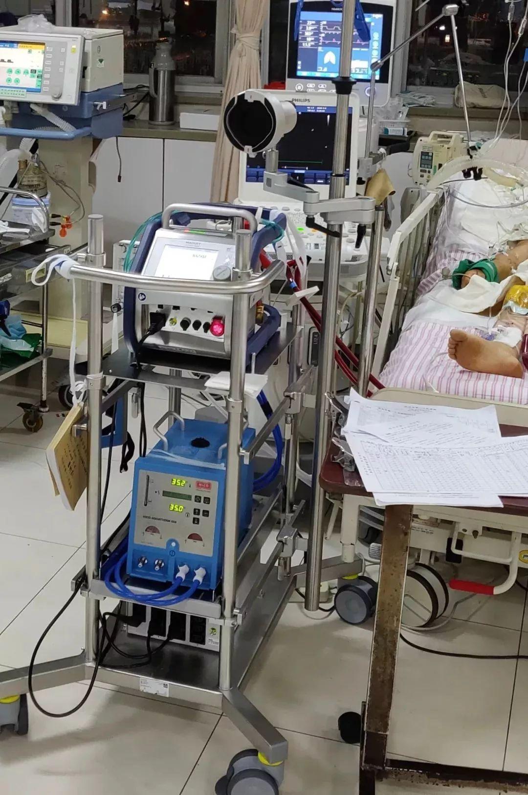 叶克膜（ECMO）是一种什么技术？ - 知乎