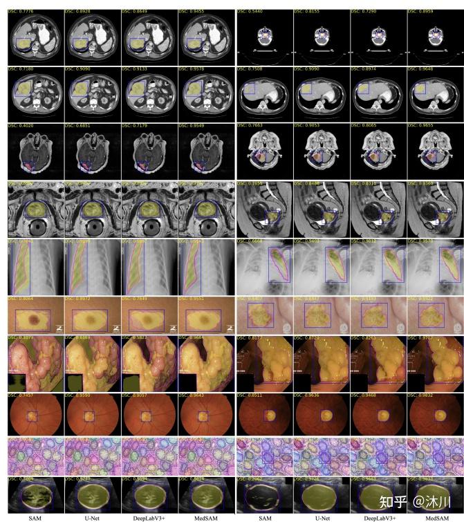 Segment Anything in Medical Images - 知乎