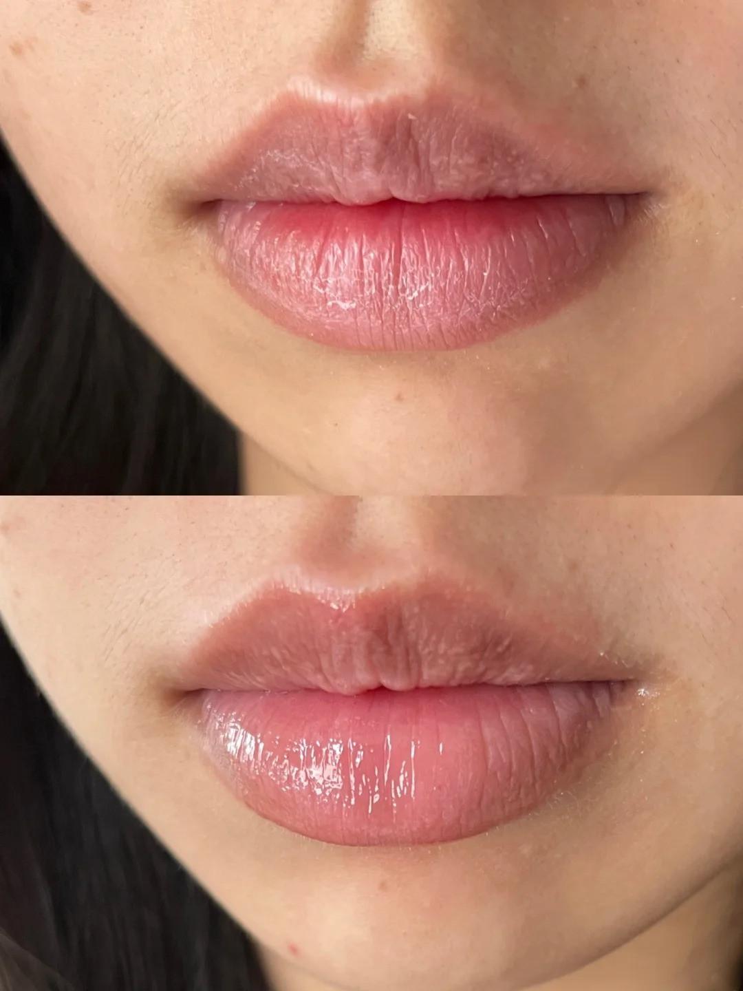 嘴唇经常起皮是什么原因?