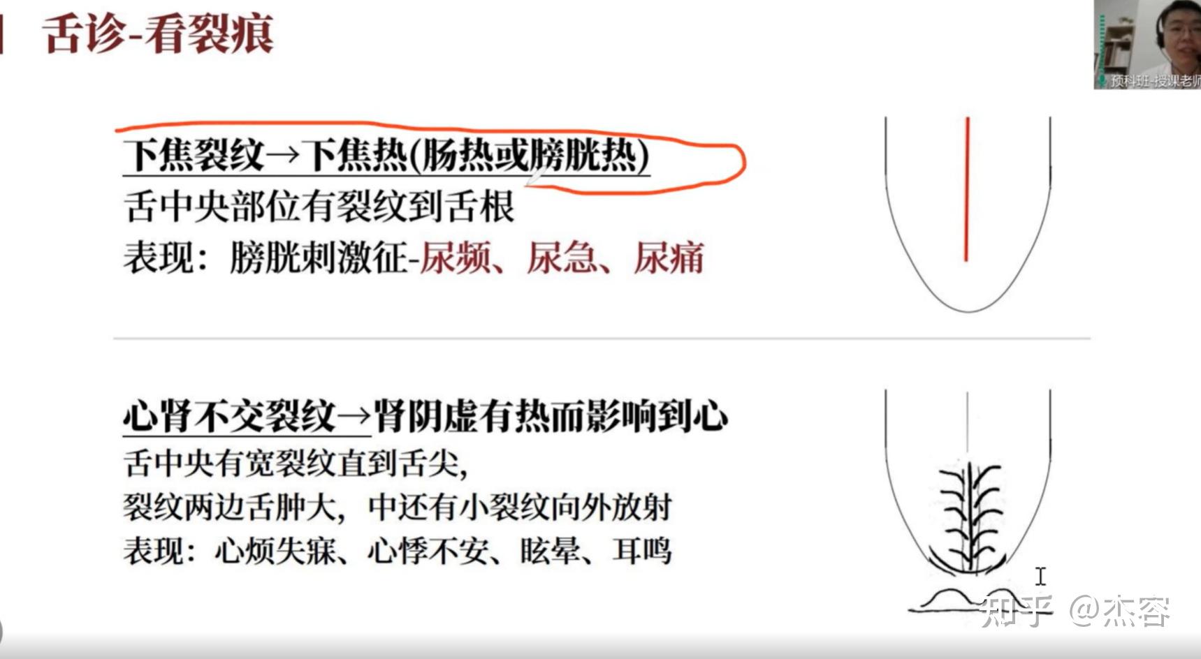 中医学习笔记5:舌诊 - 知乎
