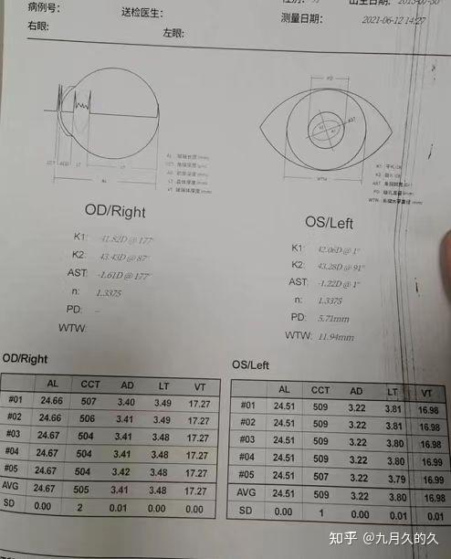 去医OD体育官方网站- OD体育APP下载- 世界杯指定投注平台院验光需要多少钱