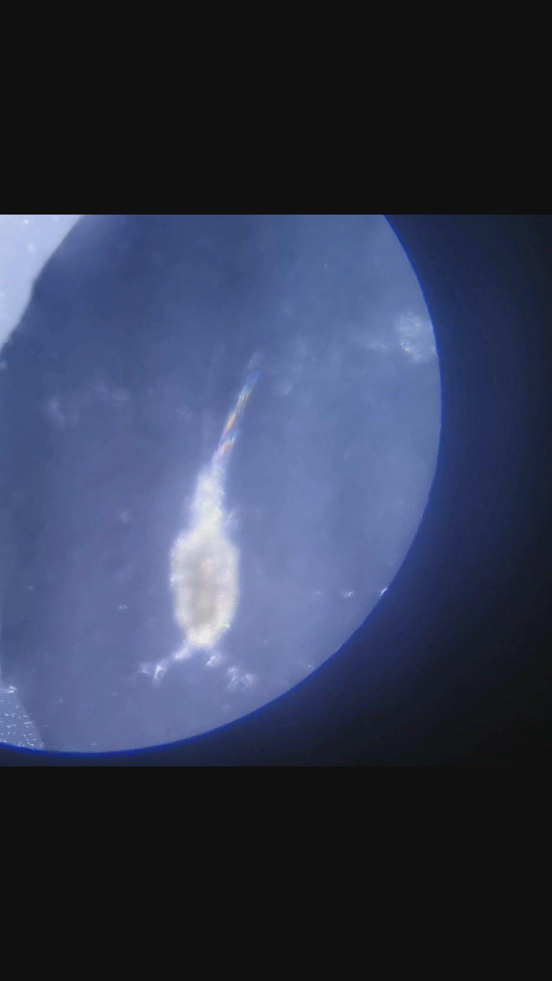 显微镜下的海水桡足类,十字花小水母