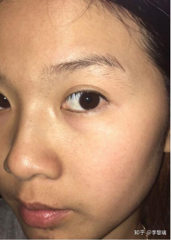 关注问题 67 写回答 登录/注册 男士护肤 皮肤美白 有什么方法可以