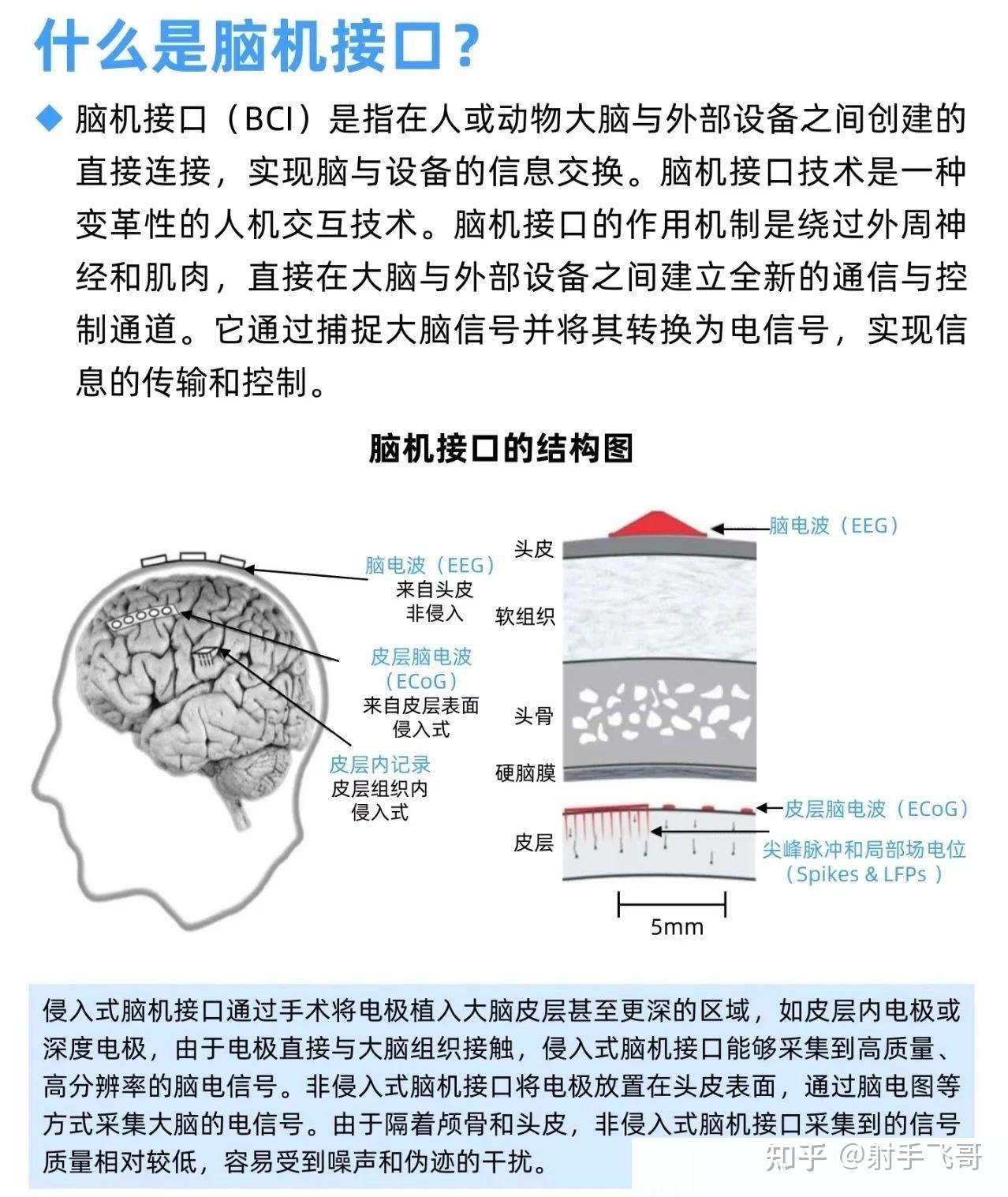 中国股市：2025值得持有的10大“脑机接口”潜力龙头股！（名单） - 知乎