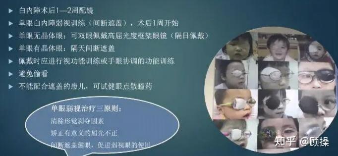 引起白瞳症最常见的儿童眼病是什么? - 知乎