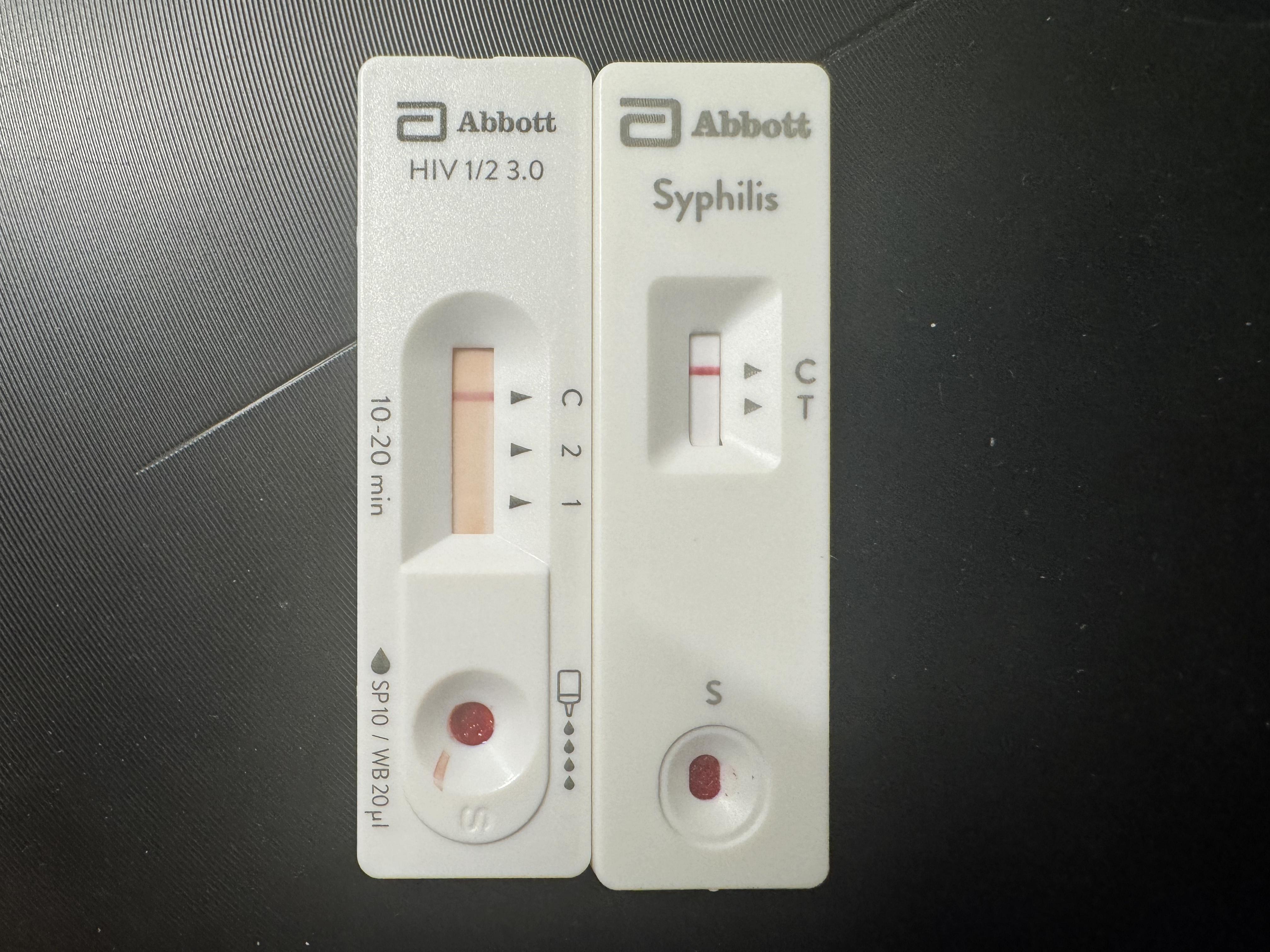 我这hiv试纸15分钟出现一条隐约的线,这是包埋线吗?