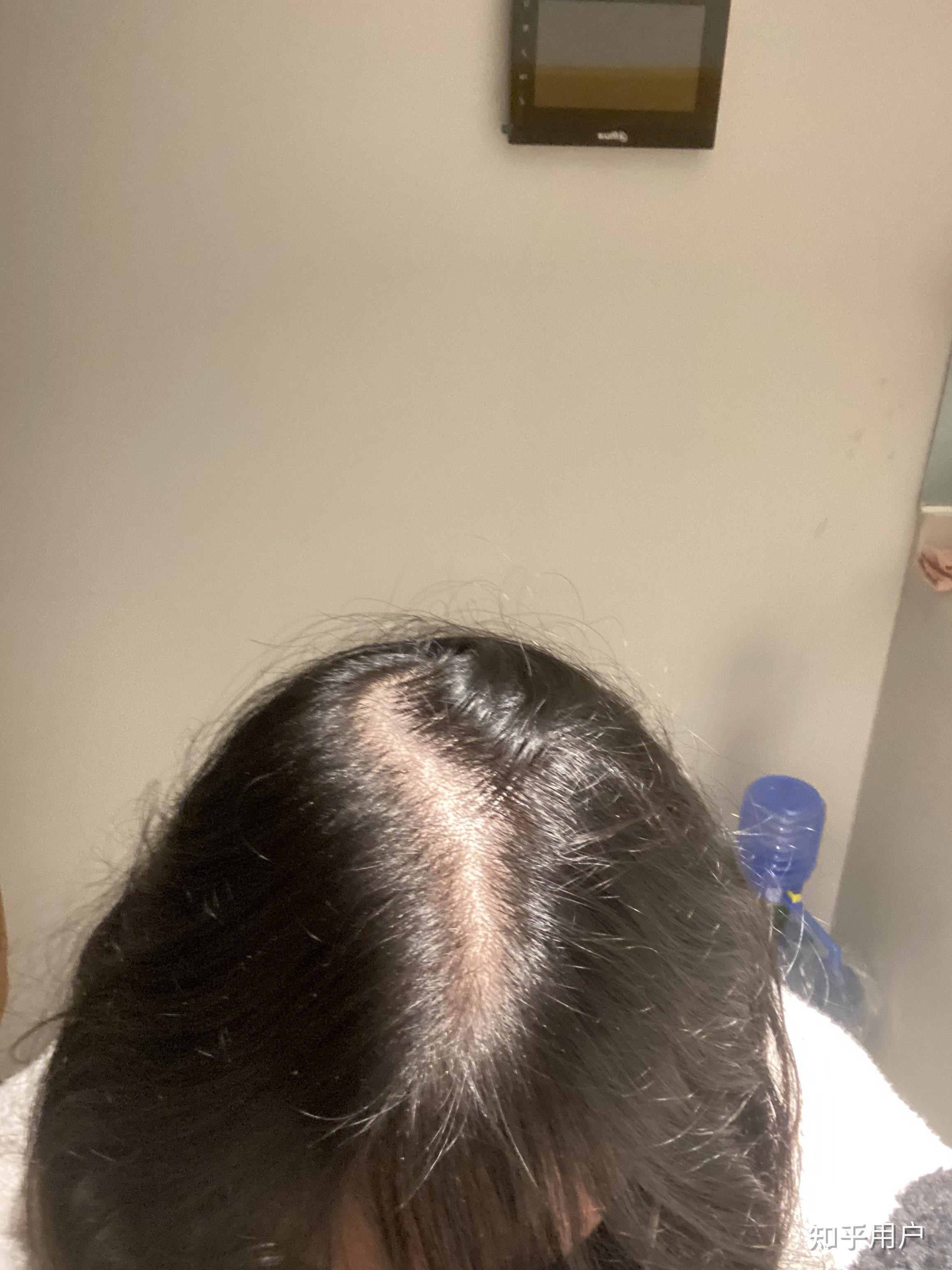 头发比较稀疏的女生适合什么样的发型