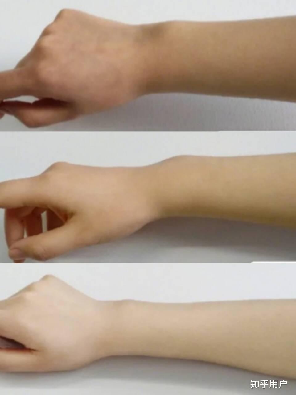 胳膊黑该怎么美白修复? - 知乎