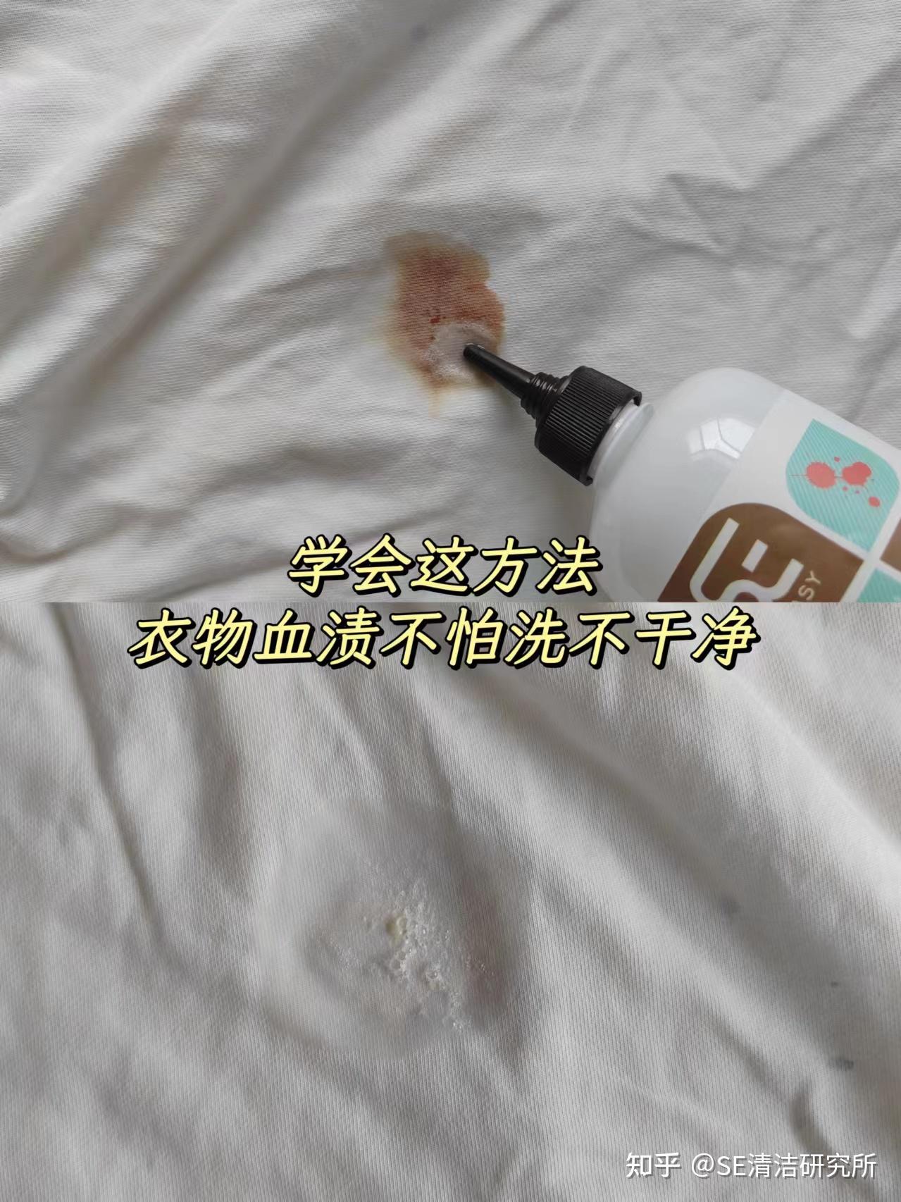 如何清洗白色衣服上的血渍? - 知乎