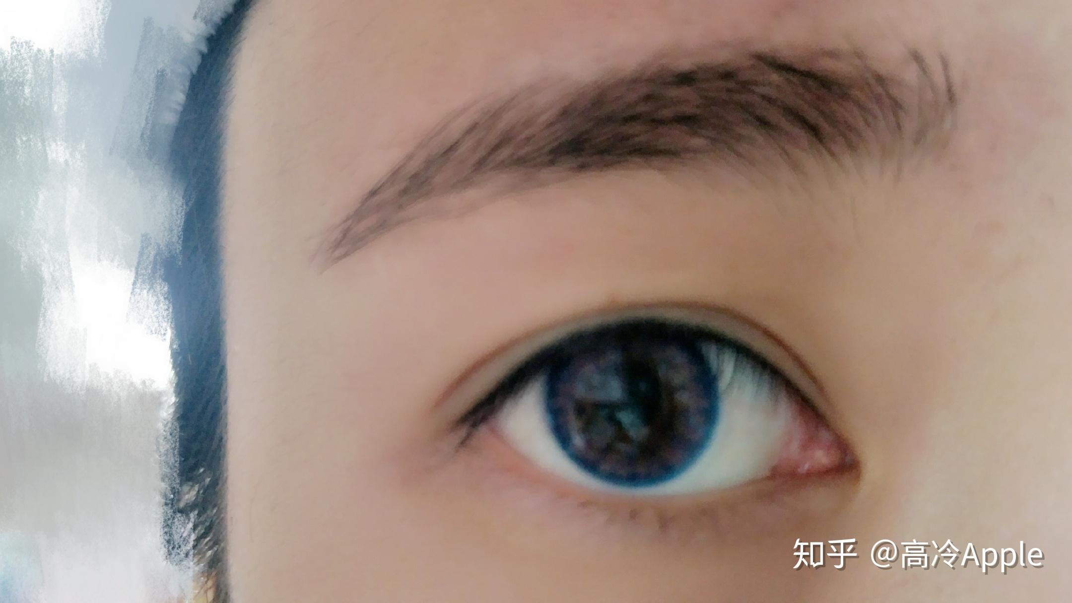 暑期想做近视手术？武汉普瑞眼科医院告诉你必须知道的几件事