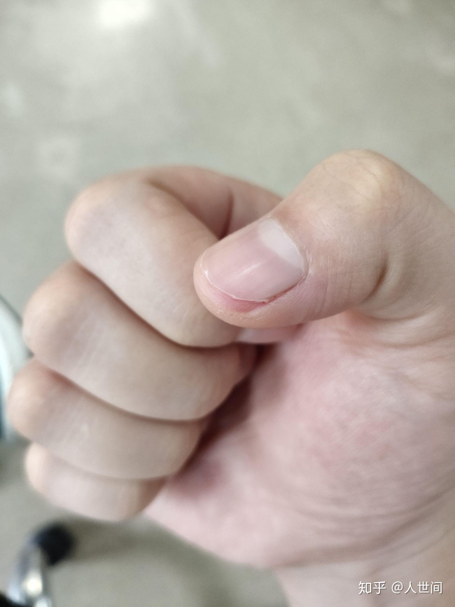 手指甲剪的很短是什么体验? - 知乎