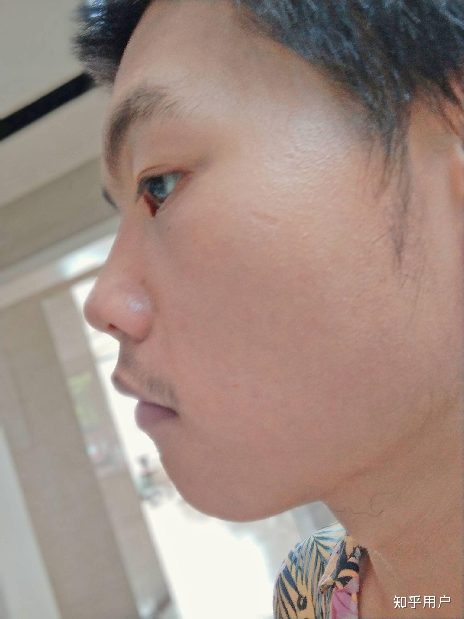 14岁的标准鼻子图片