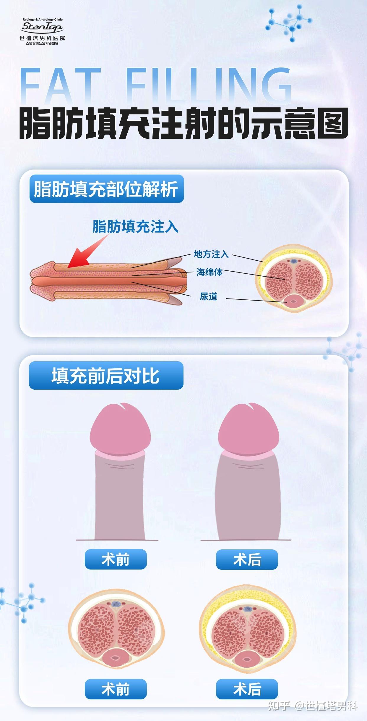 男人私密图片地方图片