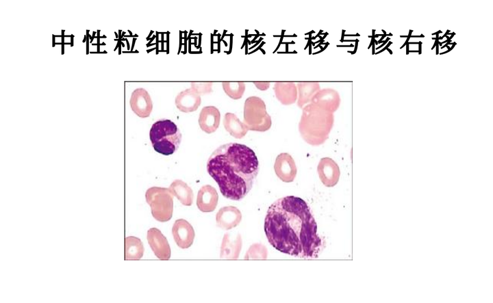 中性粒细胞的核左移与核右移 - 知乎