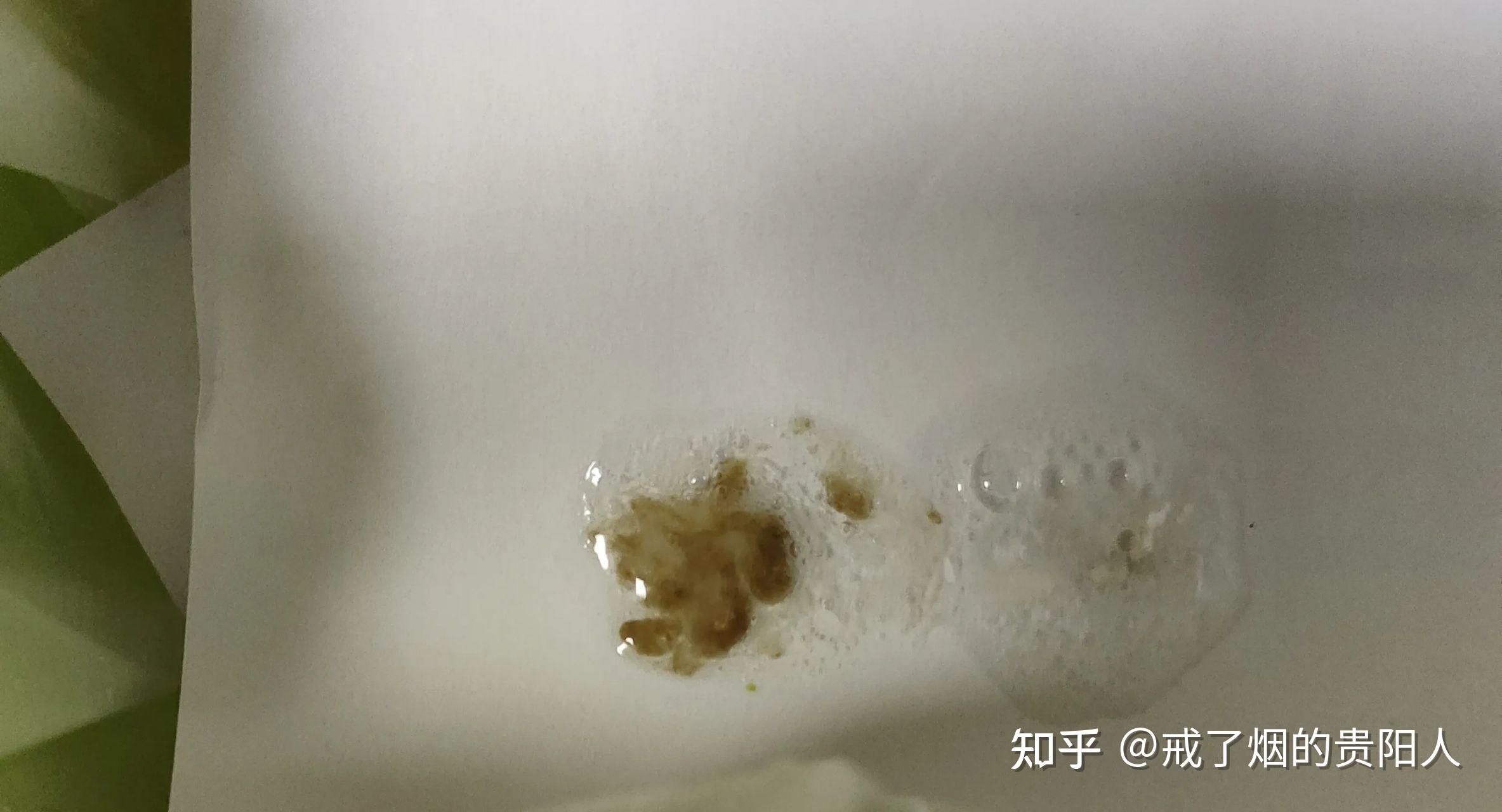 戒烟后吐出来的黑痰是什么物质? - 知乎