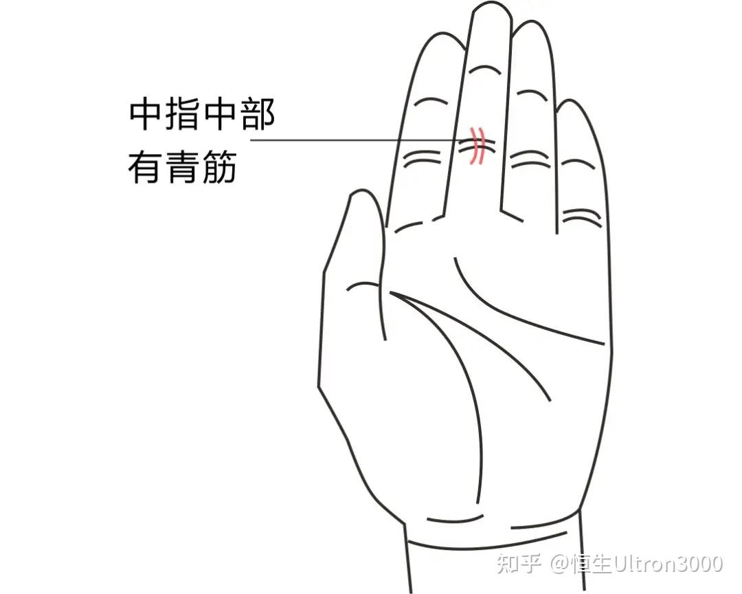 中医诊断学——手诊 - 知乎