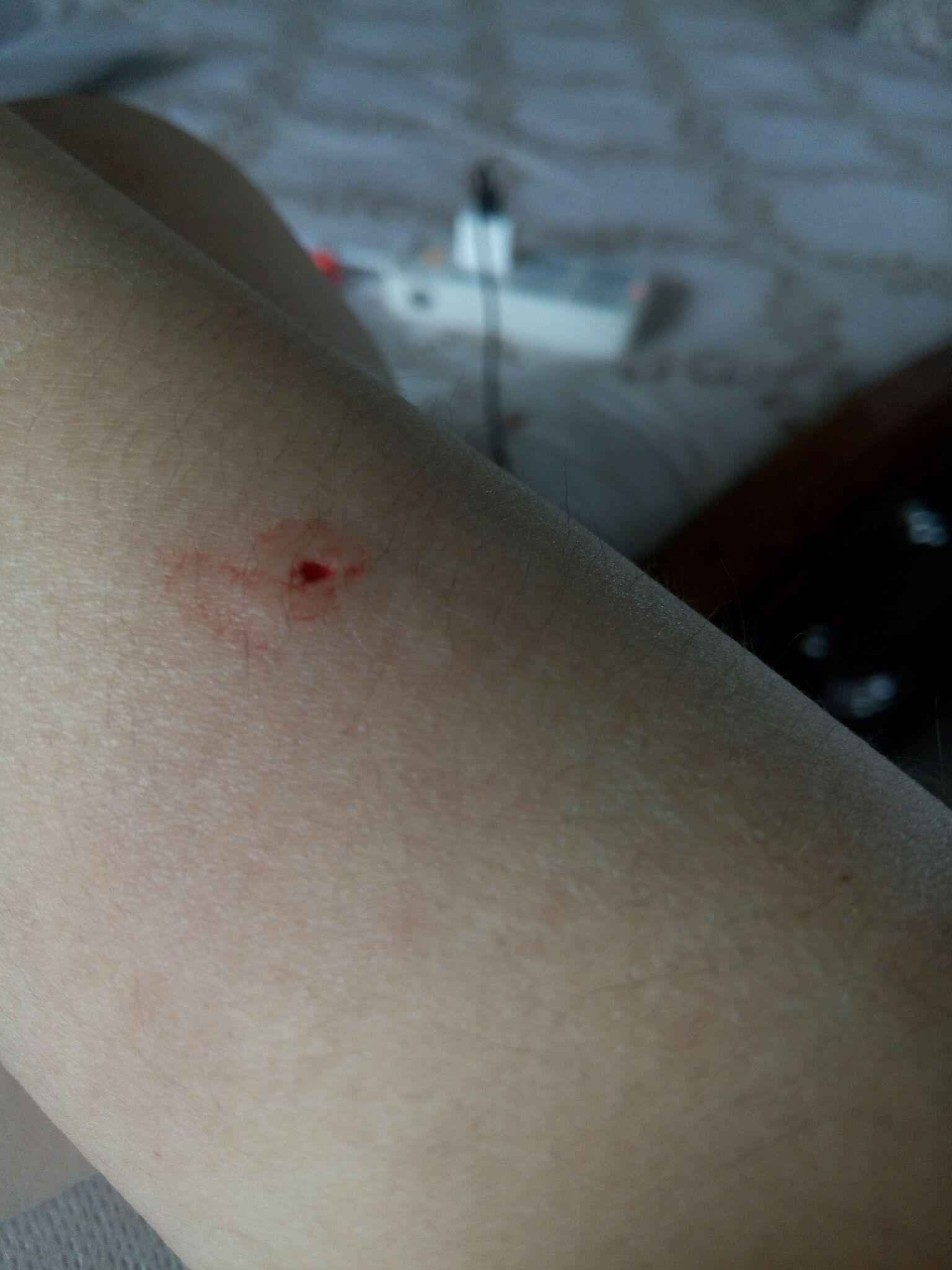 被自家的狗咬了是种怎样的体验