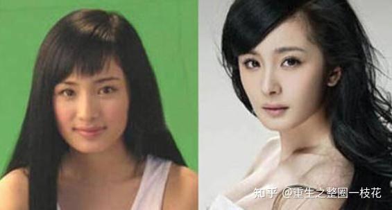 那些靠整容走上“人生巅峰”的女明星，你都认识谁？ - 知乎