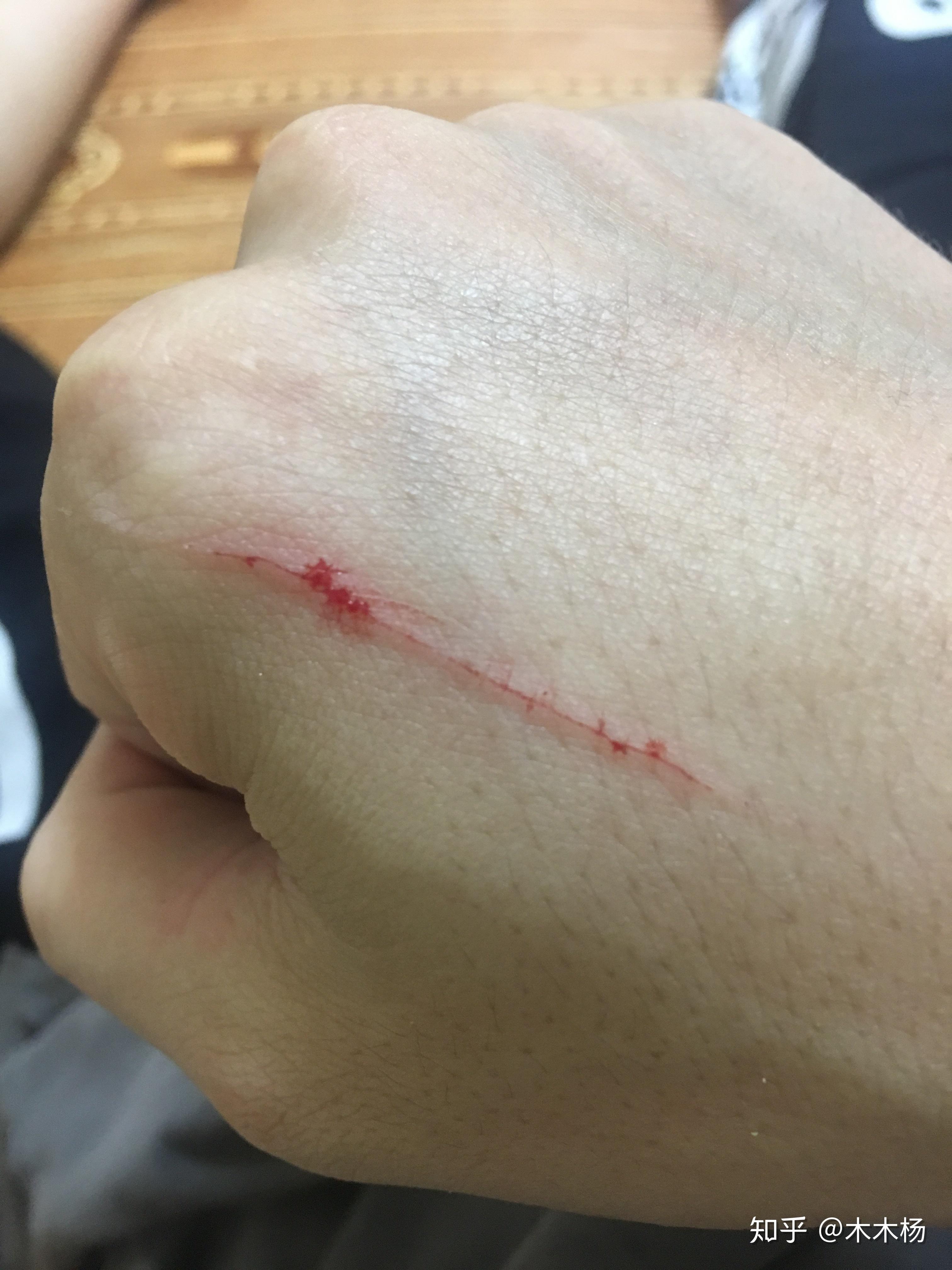 被猫抓伤之后,你会认为猫其实对主人没有情感嘛? - 知乎