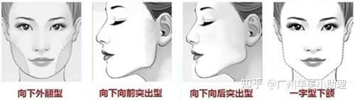 成年人“发腮”有得解,4个方法助你回归小V脸! - 知乎