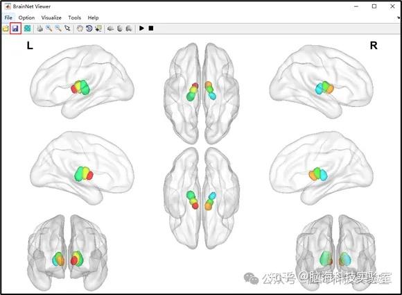 第2期 BrainNet viewer脑图绘制 - 知乎