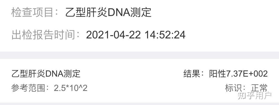 乙肝dna定量檢測多少以上可以抗病毒