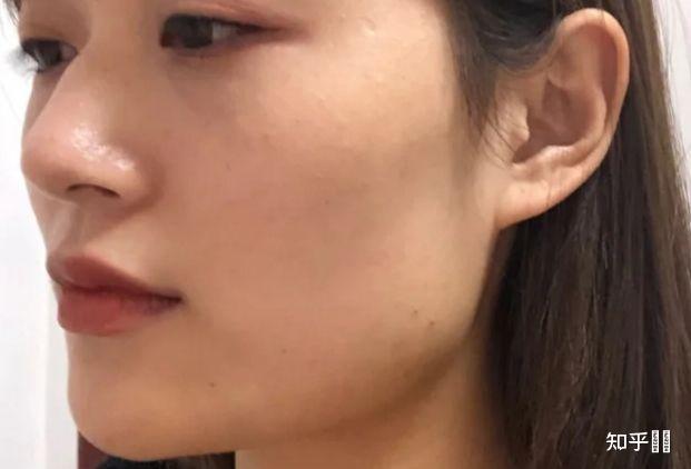 怎么瘦咬合肌? - 知乎