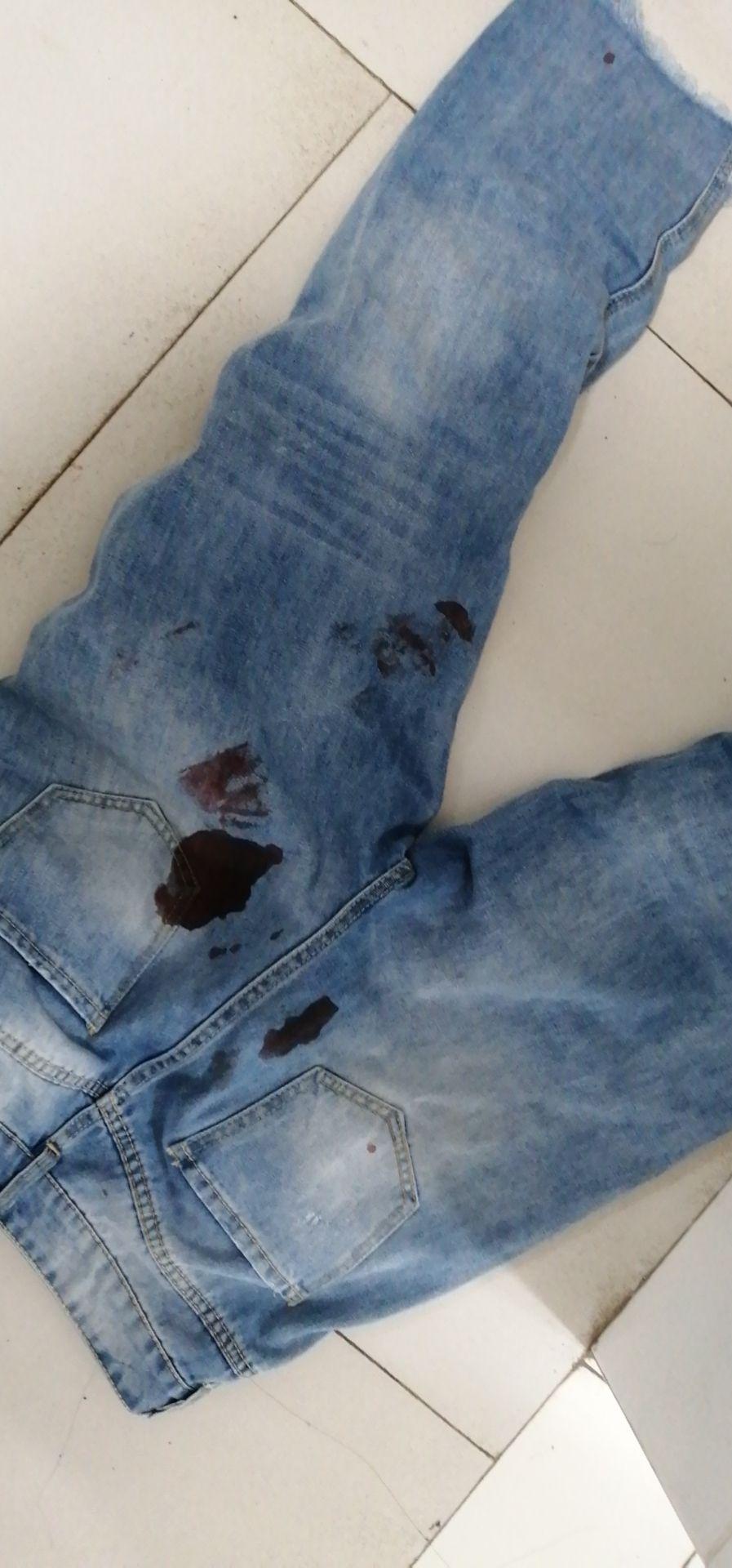 女生有哪些印象深刻的月经血崩经历