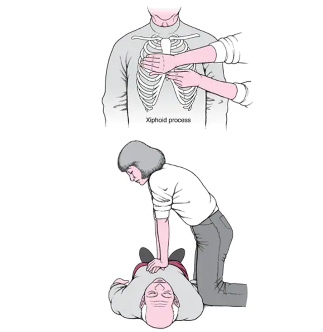 心肺复苏cpr的第一个步骤是什么啊