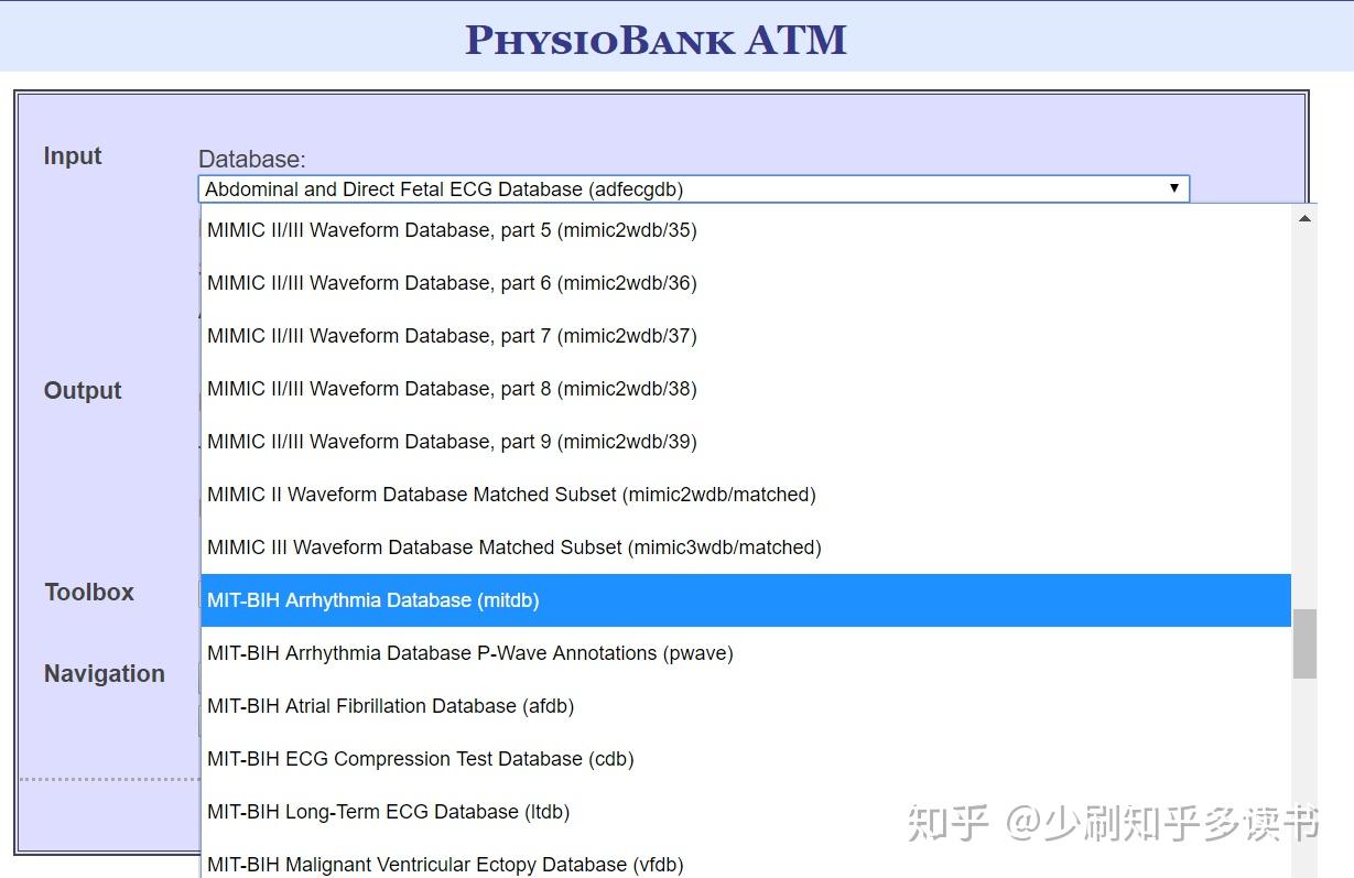 基于机器学习的心律失常分类(二)——读取MIT-BIH数据库中的心电数据[MATLAB] - 知乎
