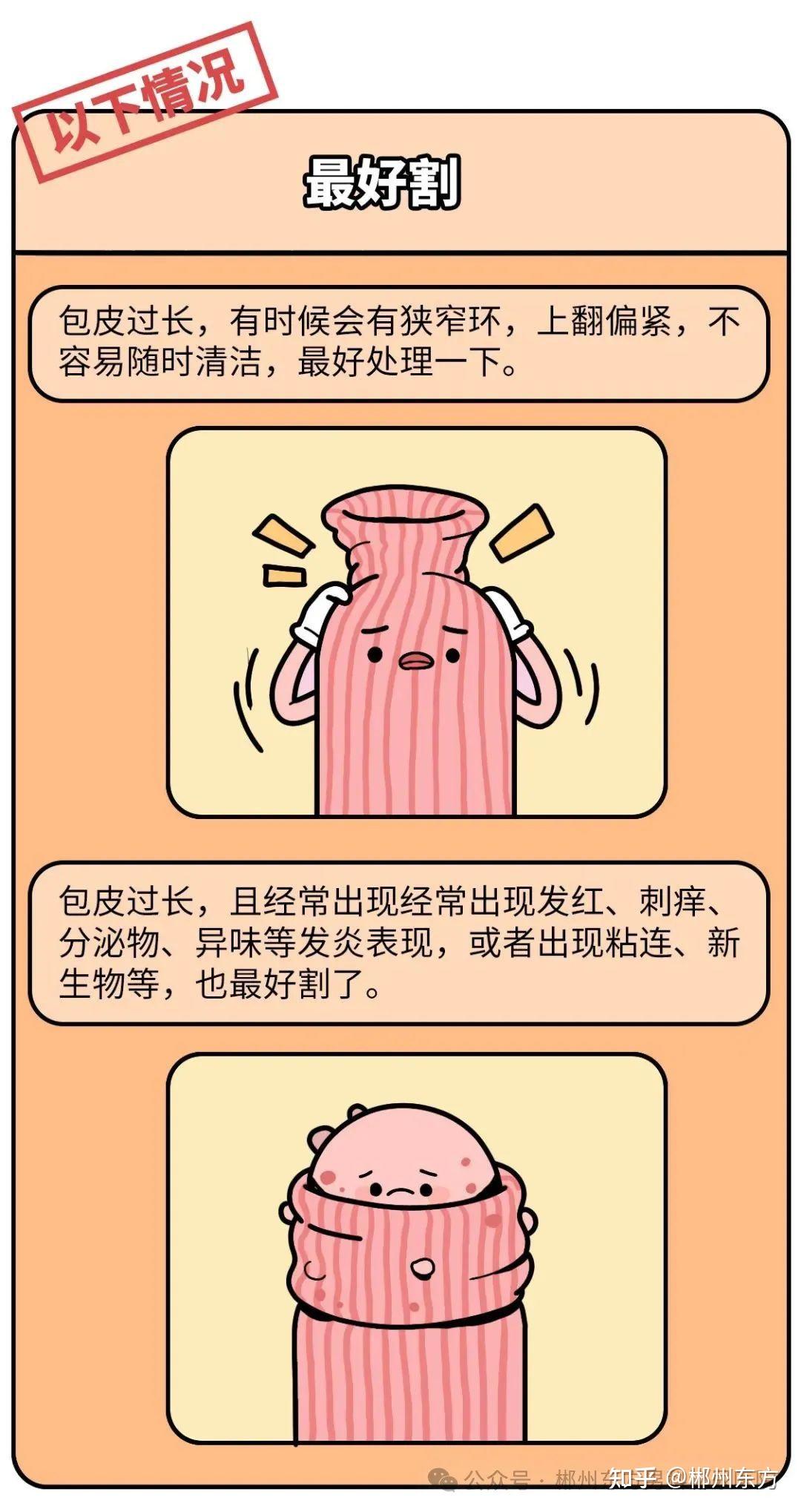 包皮割与不割的区别,怎么判断要不要割呢? - 知乎