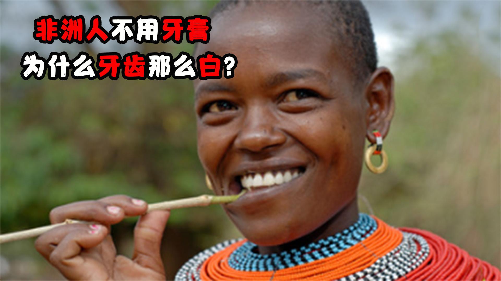 黑人的牙齿为什么总是这么白
