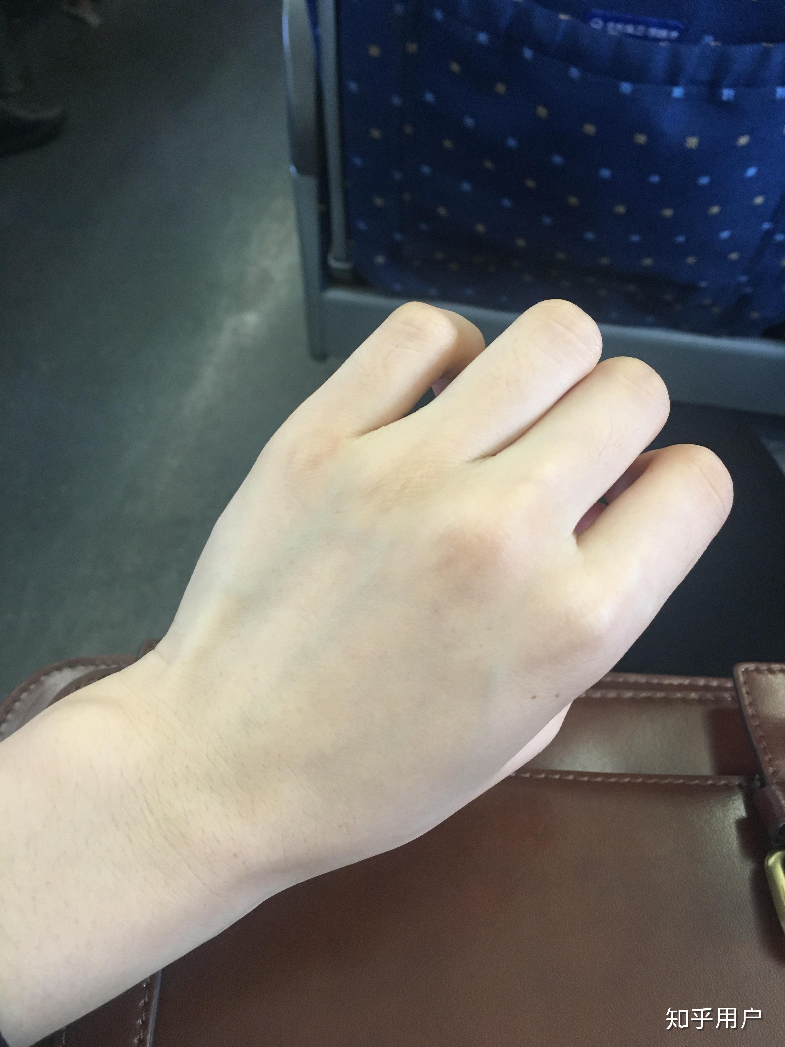 为什么我手背皮肤很细嫩很滑而手心却干燥粗糙呢