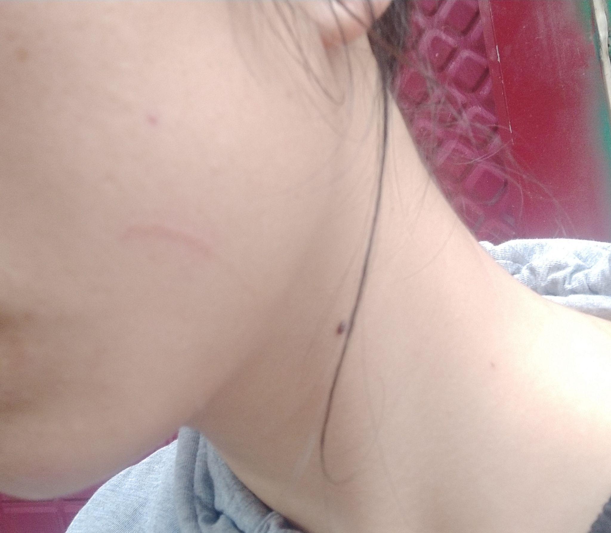 猫咪抓我脸了有一条痕迹会不会留疤? - 知乎