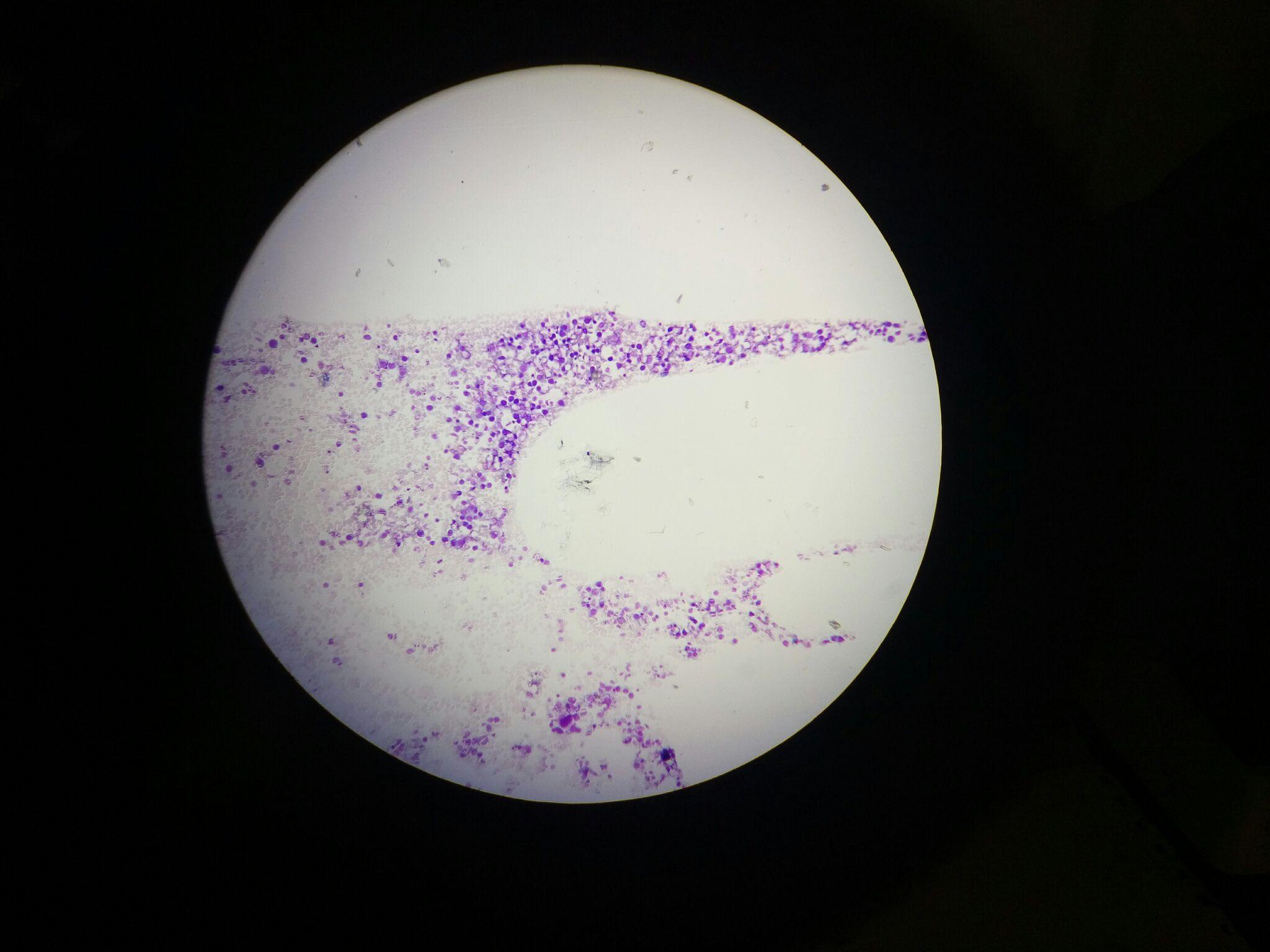 显微镜血液粘稠度图片图片