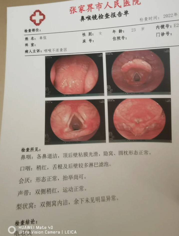 慢性咽炎,喉咙里长期有痰,怎么缓解? - 知乎