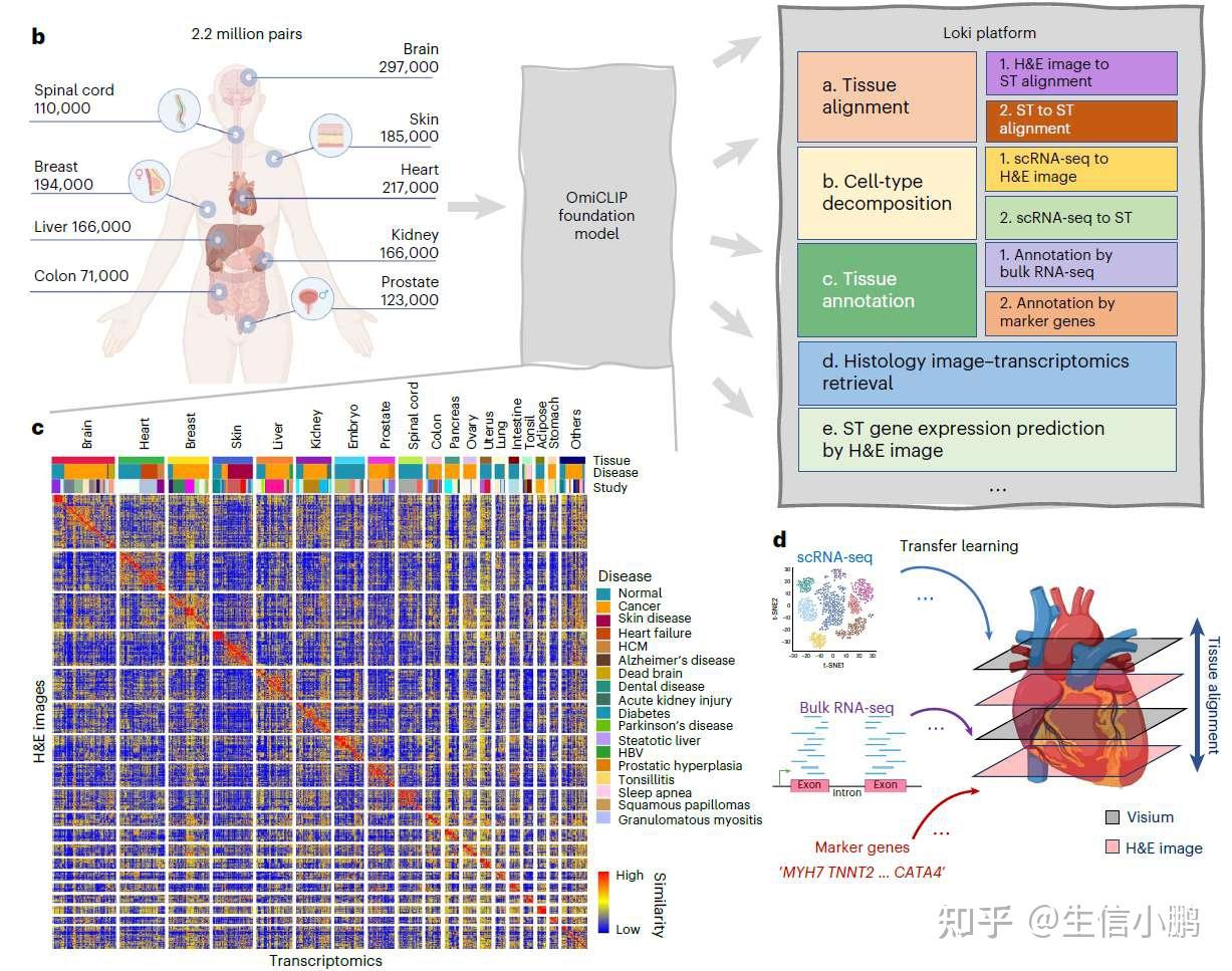 Nature Methods | LOKI 平台：将空间转录组与 H&E 图像连接的视觉-组学模型 | 让病理切片“看见”基因表达 - 知乎