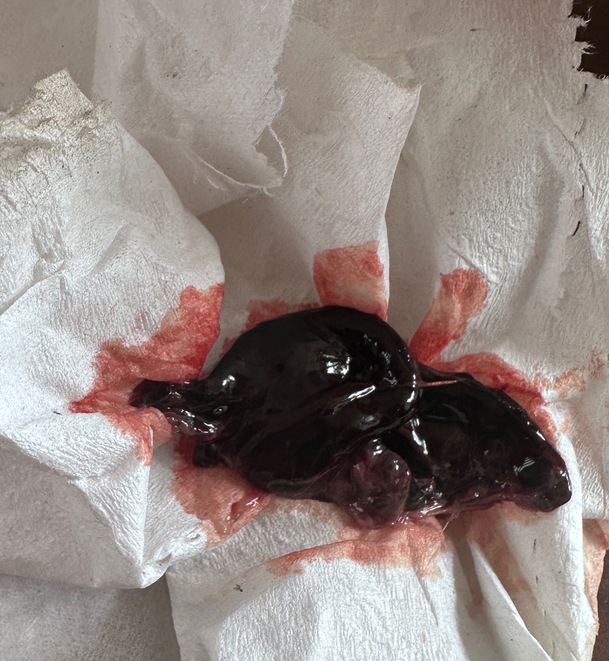 拔牙之后的血凝块几天后可以清理干净?