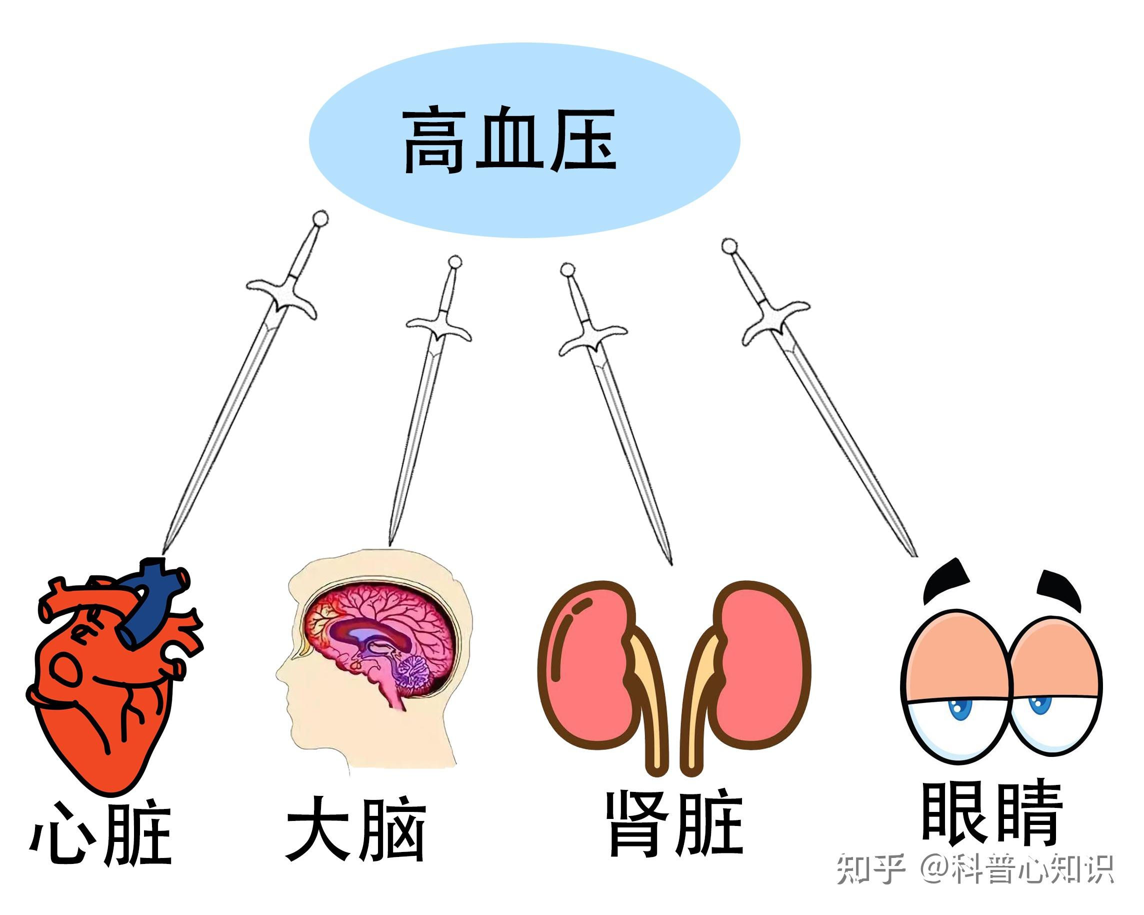 为什么「高血压」通常被称为沉默杀手? - 知乎